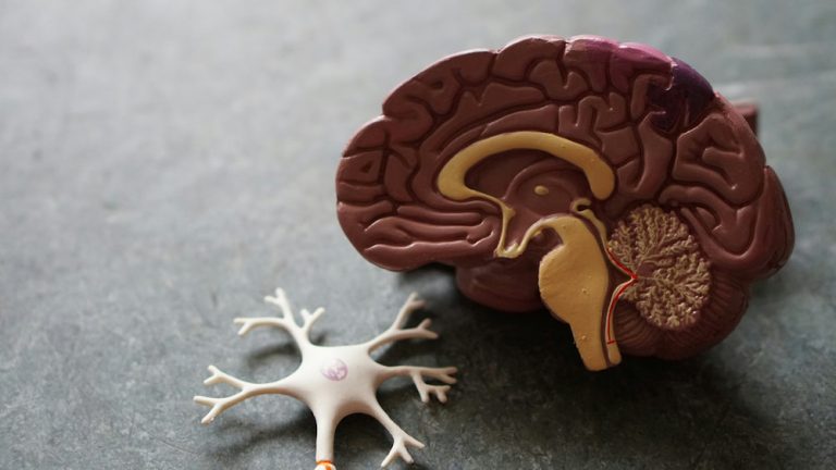 Neural connections in ADHD brain